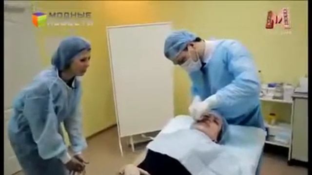 Нити APTOS мгновенный лифтинг эффект, подтяжка и омоложение лица смотреть онлайн