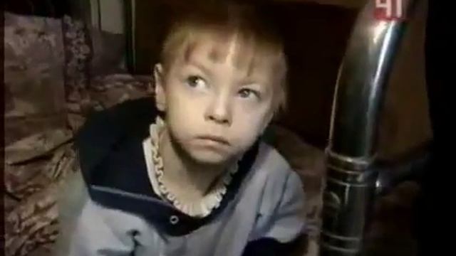 Нашествие клопов - на детях нет живого места от укусов клопов смотреть онлайн