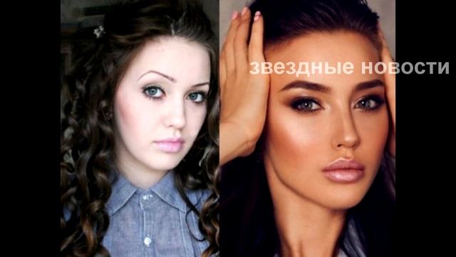 Анастасия Костенко до и после пластики смотреть онлайн
