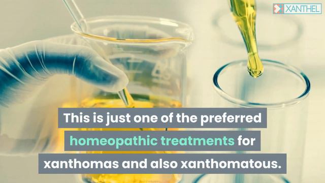 HOMEOPATHIC XANTHELASMA REMEDIES - Brought To You By XANTHEL ® Easy Xanthelasma Removal !