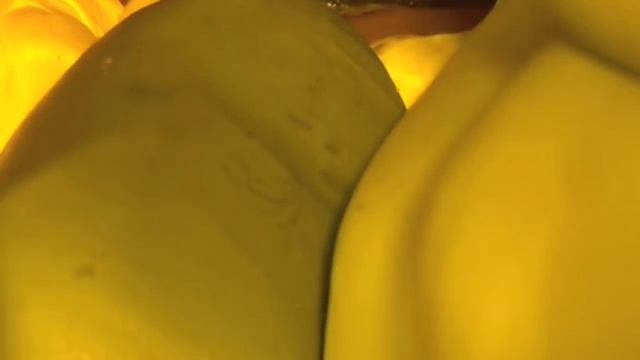 Запечатывание шахты абатмента смотреть онлайн