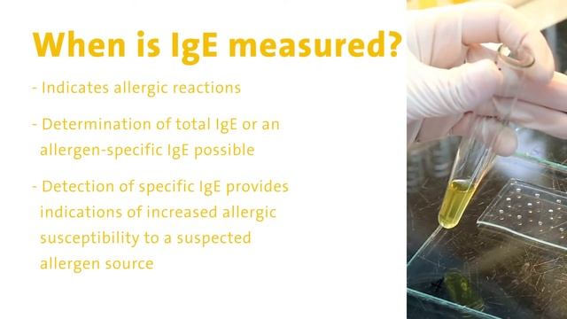 Lab values explained no. 3: Allergy Diagnostics - Immunoglobulin E смотреть онлайн