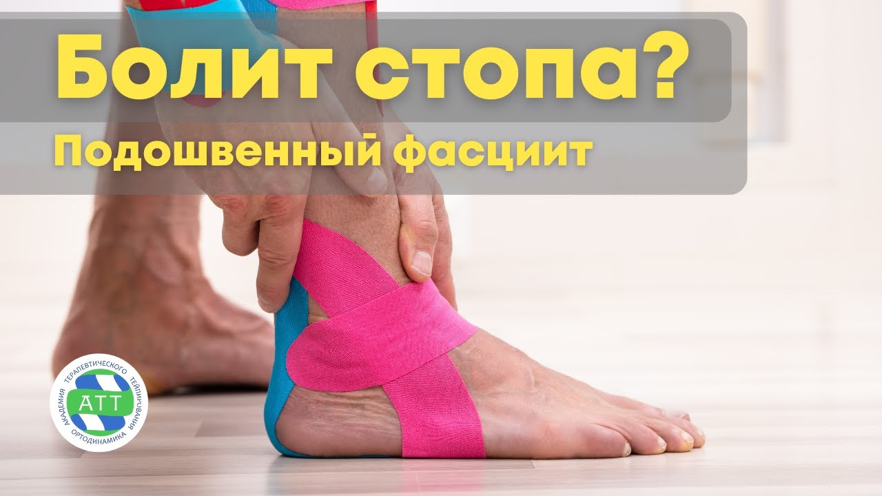 ✅Боль в стопе. Подошвенный фасциит. Тейпирование стопы. смотреть онлайн