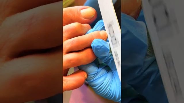 Комбинированный гигиенический педикюр смотреть онлайн