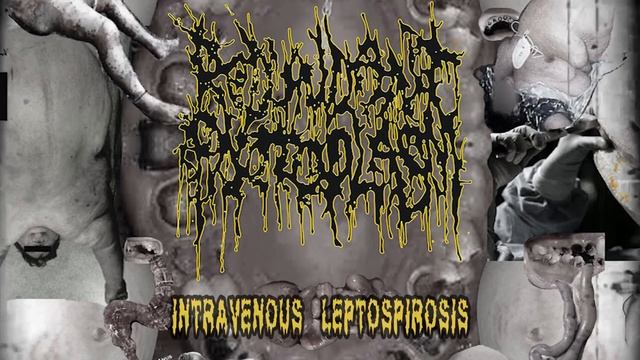 Redundant Protoplasm - Intravenous Leptospirosis [SINGLE] (2019 - Goregrind) смотреть онлайн