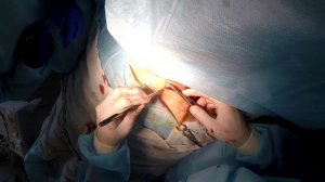 Перелом ключицы