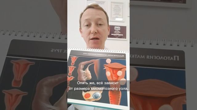 Можно ли планировать ЭКО при множественной миоме матки? Ответ в видео ☝️ смотреть онлайн