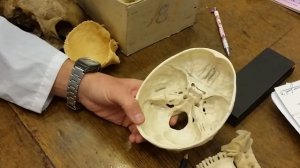 Мозговой череп. #Анатомия