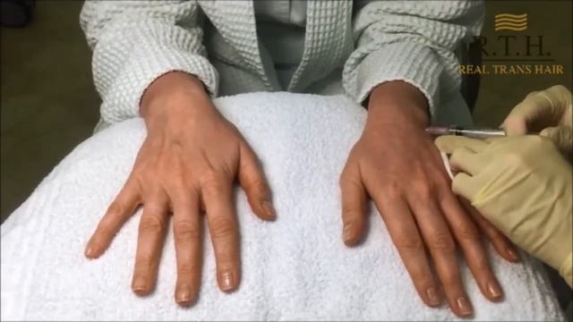 Забудьте про крем для рук! Увлажняем кожу изнутри с помощью биоревитализации! смотреть онлайн