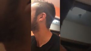 Огромный нарыв на щеке! Давим прыщи.