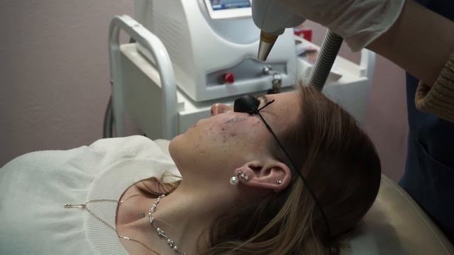 Лазерное Удаление Татуировки На Лице смотреть онлайн