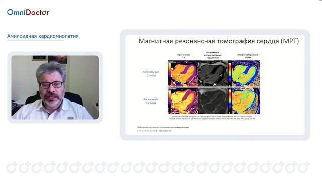 МРТ смотреть онлайн