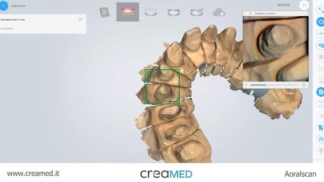 [Aoralscan] Test scansione cavità modello in gesso смотреть онлайн