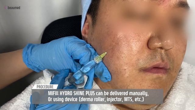 Product Information & Live Demo with Needle Injection : MiFill Hydro Shine Plus смотреть онлайн
