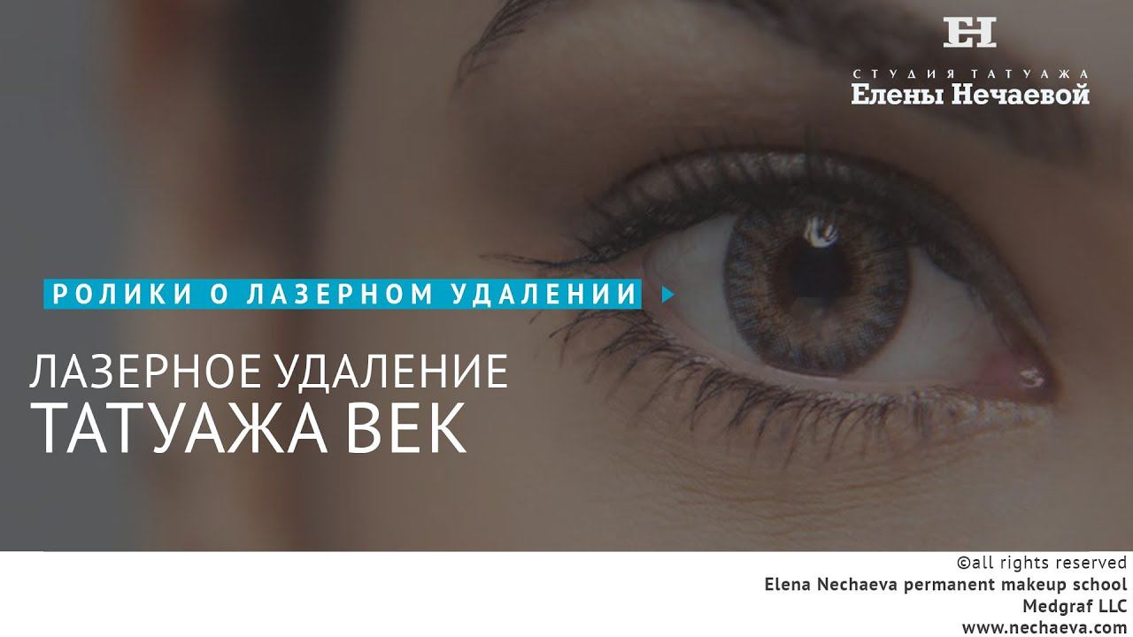 Лазерное удаление татуажа век. #татуаж #лазерноеудаление смотреть онлайн