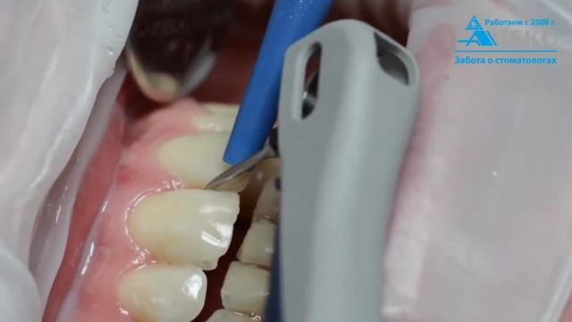 Работа насадки - кюрета Paro, арт. 2030-151-04E смотреть онлайн