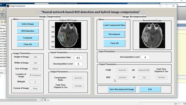 MATLAB code of ROI detection and Hybrid image compression смотреть онлайн