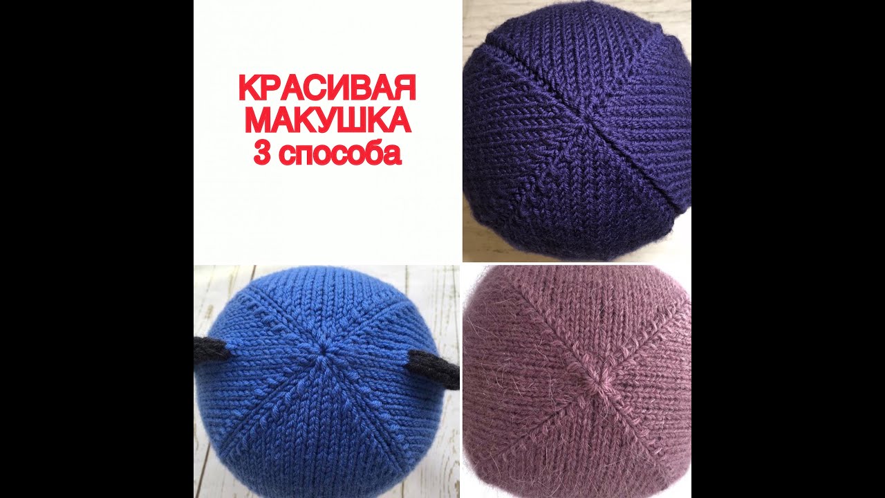 Красивая макушка. 3 способа смотреть онлайн