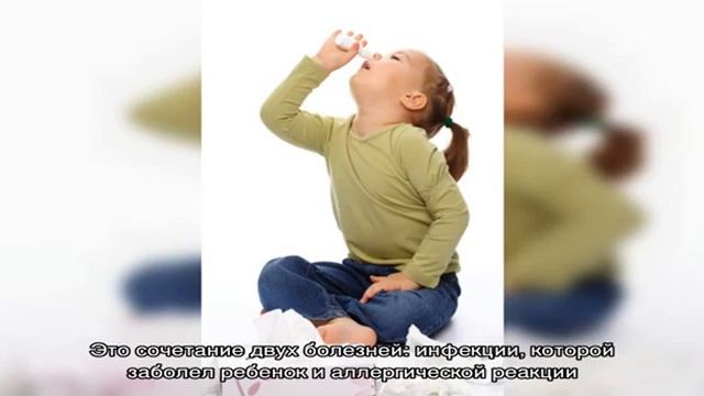 Формы и симптомы аллергического ринита у детей. Лечение аллергического насморка и заложенности нос.