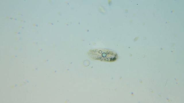 The incredible adventures of infusoria under the MICROSCOPE // invisible world смотреть онлайн