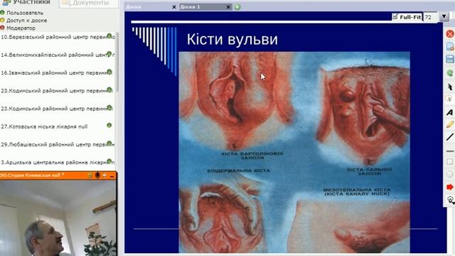 Леонид Арнольдович Товштейн - опухоли шейки матки (доска) смотреть онлайн
