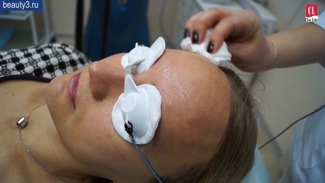 Фотоомоложение лица в центре косметологии Cleo Line смотреть онлайн