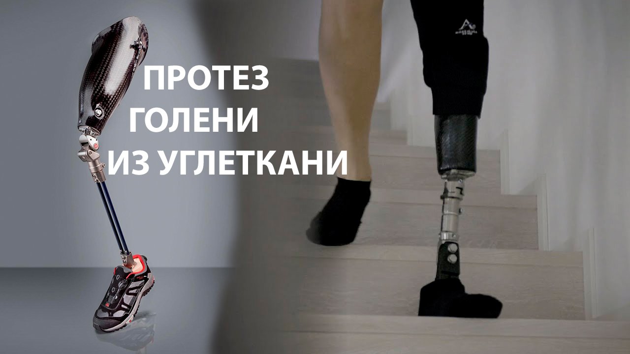 Изготовление протеза голени из углеткани