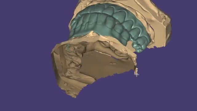 Exocad Full arch implant bridge / all on 3/6/7 implants ! смотреть онлайн