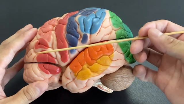 This is why migraine happens смотреть онлайн