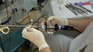 Гистерорезектоскопия, полипэктомия