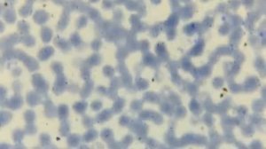 Нейтрофилы