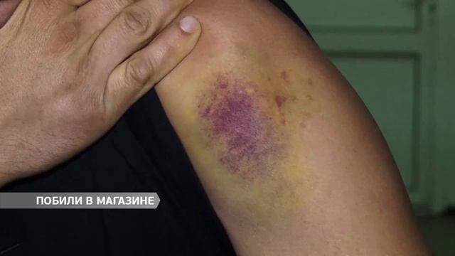 Вместо конфет – сотрясение мозга смотреть онлайн