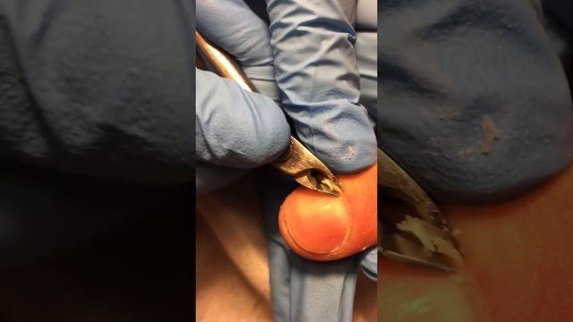 МУЖСКОЙ МАНИКЮР. ОБРЕЗНОЙ МАНИКЮР смотреть онлайн