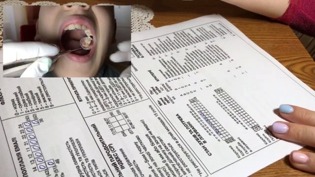 Заповнення карти реєстрації стоматологічного статусу (ВООЗ) смотреть онлайн