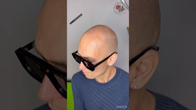 Не мирись с облысением! Это можно исправить. Трихопигментация лучше чем пересадка волос. SMP Moscow смотреть онлайн