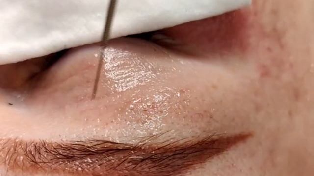 Холодная Плазма | Обучение смотреть онлайн