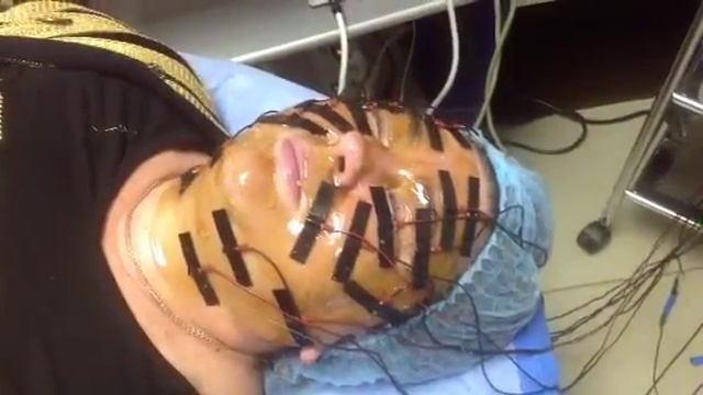 Электромиостимуляция мышц лица смотреть онлайн