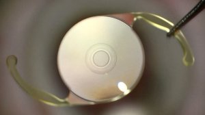 AcrySof IQ PanOptix или AcrySof IQ ViVity какая линза лучше