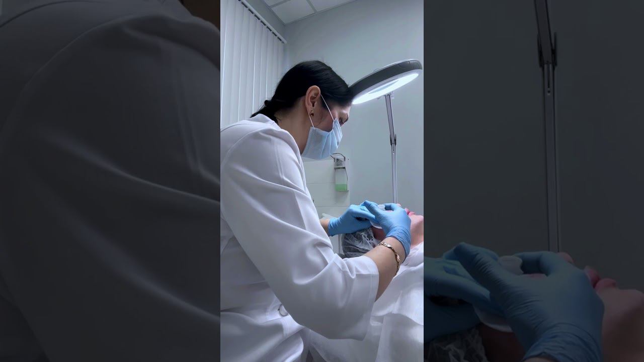 Биоревитализация Revi Strong смотреть онлайн