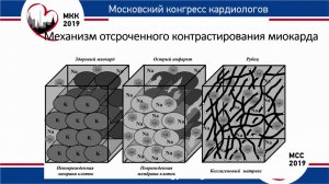 Е. А. Мершина. Применение МРТ в диагностике ИБС и кардиомиопатий.