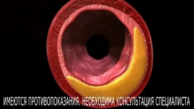 Боль в области сердца смотреть онлайн