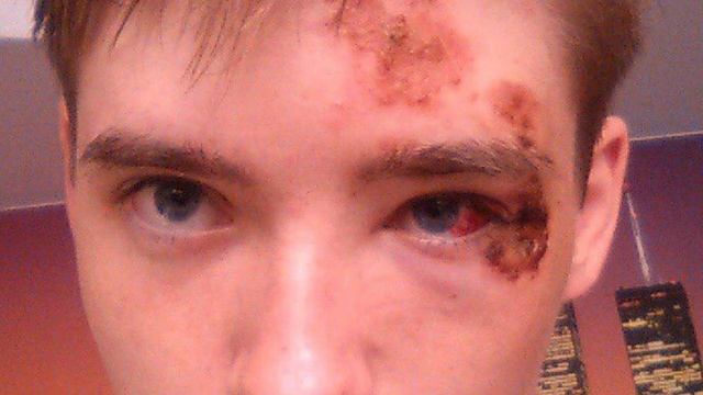 МАКС ВАЩЕНКО РАЗБИЛ ЛИЦО ?!!! @max.vashchenko @vashchenko_live смотреть онлайн