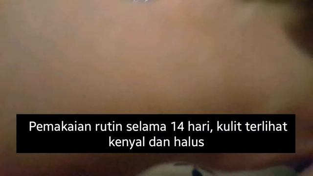 Review anti aging serum Dewytree Ultra Vitalizing Snail Serum смотреть онлайн