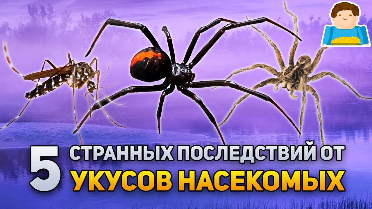 Топ 5 самых СТРАННЫХ последствий от укусов насекомых | Plushkin смотреть онлайн
