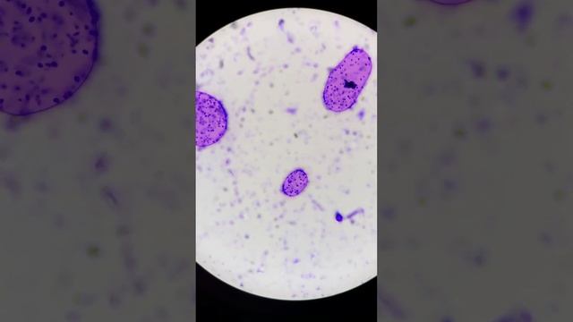 КАК ОЧИСТИТЬ ТЕН И БАРАБАН ОТ НАКИПИ,ПЛЕСЕНИ,ГРИБКА И МИКРООРГАНИЗМОВ в 2 шага! смотреть онлайн