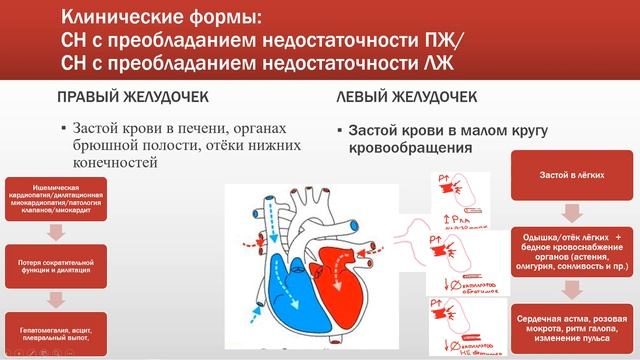 Сердечная недостаточность смотреть онлайн