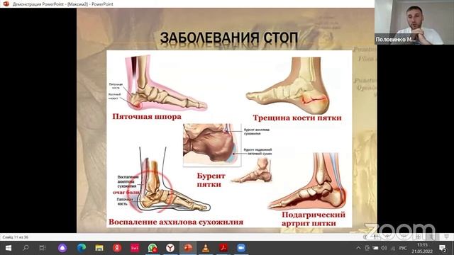 Стопа. Максим Половинко