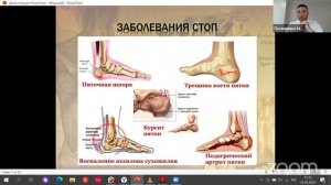 Стопа. Максим Половинко