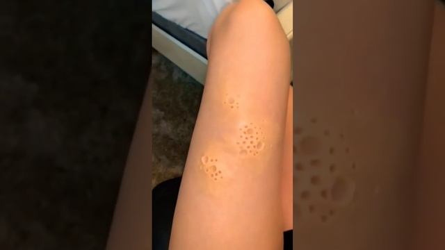 My leg hurts. Do you feel pain? ? #sfx #sfx_makeup #youtubeshorts #makeup #foryou #fypシ #art #short смотреть онлайн