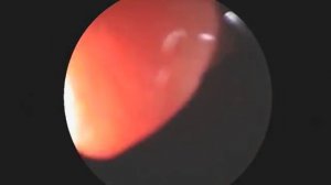 Желудок изнутри